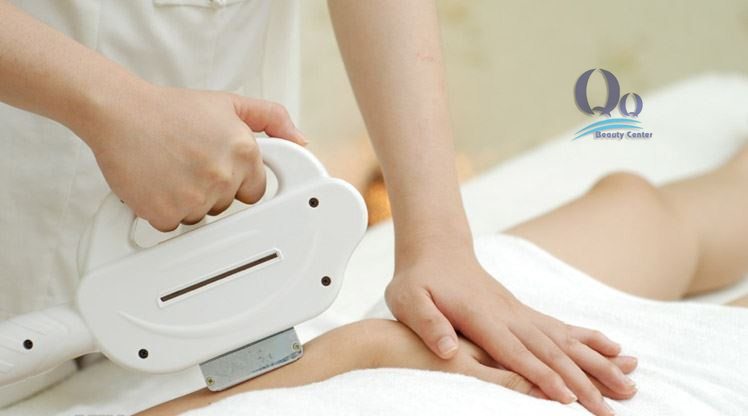 Công nghệ New E- Light triệt lông hiệu quả