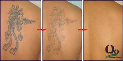 Tay hinh xam hieu qua nhat hinh anh 2