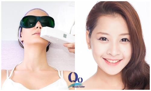 Triệt lông vĩnh viễn vùng da mặt