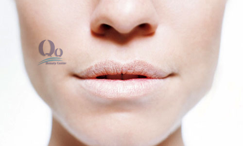 Cach chua da moi bi bong troc hieu qua hinh anh 