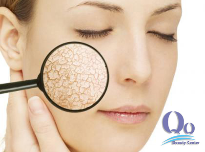 Cách trị da mặt khô bong tróc nhanh nhất