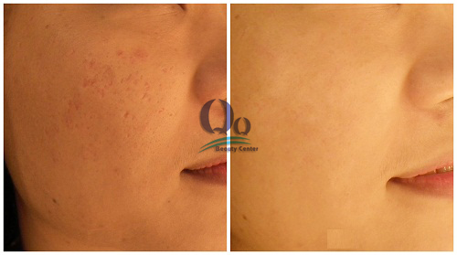 Dia chi chua da mat san sui vi mun uy tin  hinh anh 2