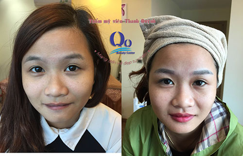 Tư vấn dịch vụ phun môi thẩm mỹ  