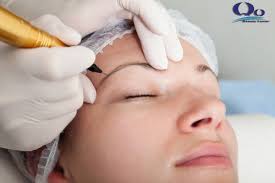 Xoá xăm lông mày an toàn