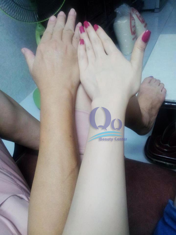 Lam trang cong nghe cao tai phu xuan - Thanh Quỳnh