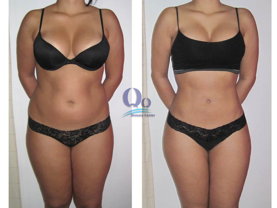 Dia chi vang giam beo bung an toan hinh anh 2