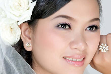 Điều trị sẹo lõm trên mặt hiệu quả