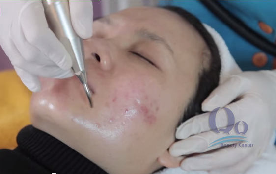 Meo hay chua da mat san sui va ngua  hinh anh 2