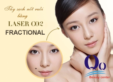 Not ruoi o mep trai co y nghia gi