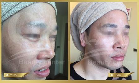 Lam dep cho long may nam gioi