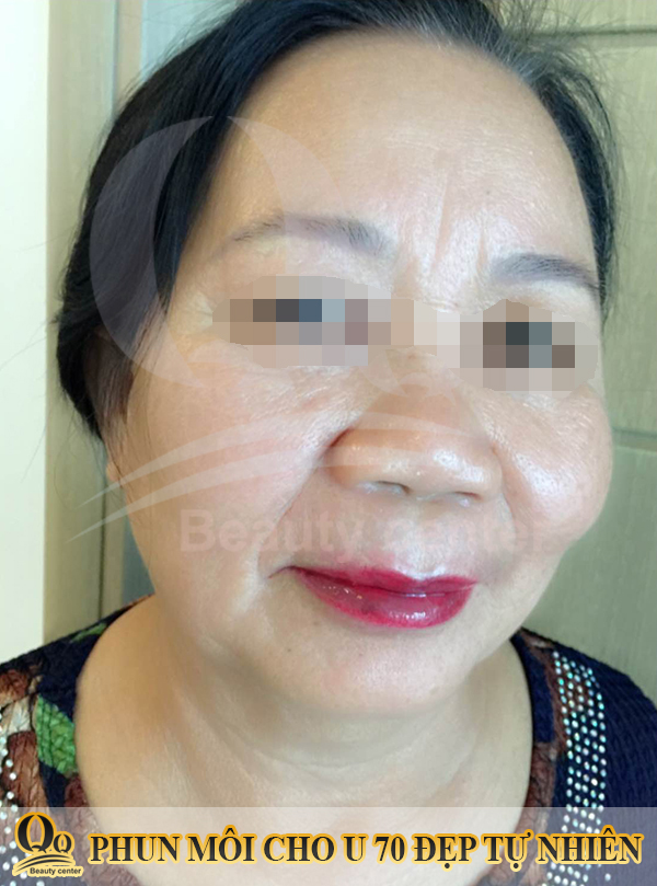 Cách làm nhạt màu môi xăm