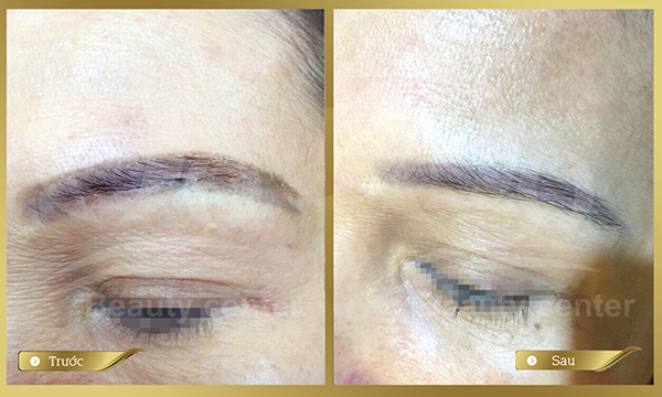 Xoa phun xam long may