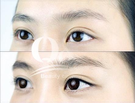 Địa chỉ thẩm mỹ phun xăm mí mắt đẹp Hà Nội