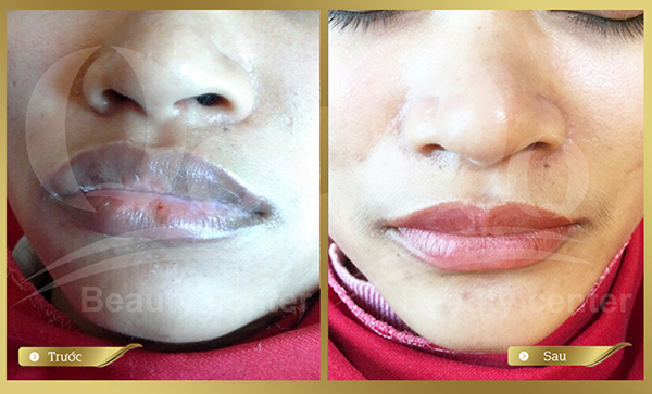 Phun xăm môi giá rẻ có ổn không ?