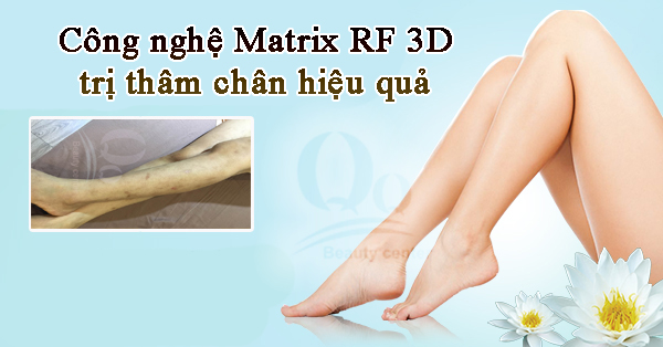 Xóa sẹo thâm ở chân bao nhiêu tiền ?