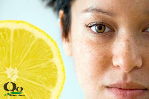 Cách điều trị nám sau khi sinh