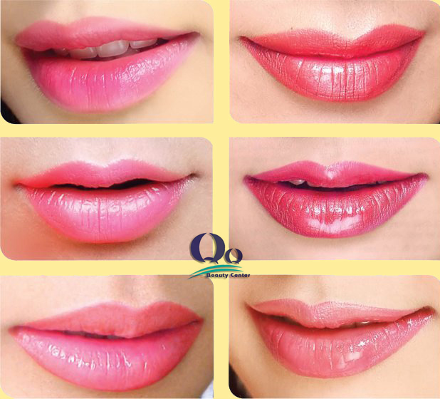 phun moi o dau dep hinh anh 2