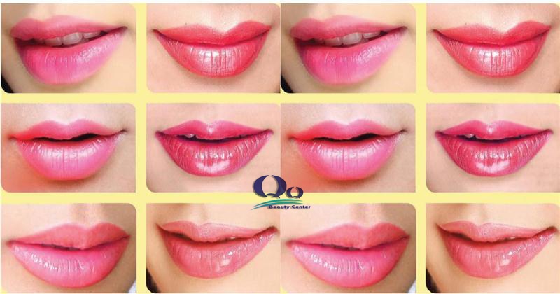 phun moi dep tu nhien hinh anh1