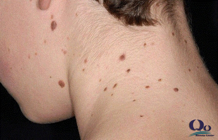 tay not ruoi an toan hinh anh