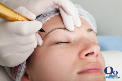 Theu long may co xoa duoc khong hinh anh