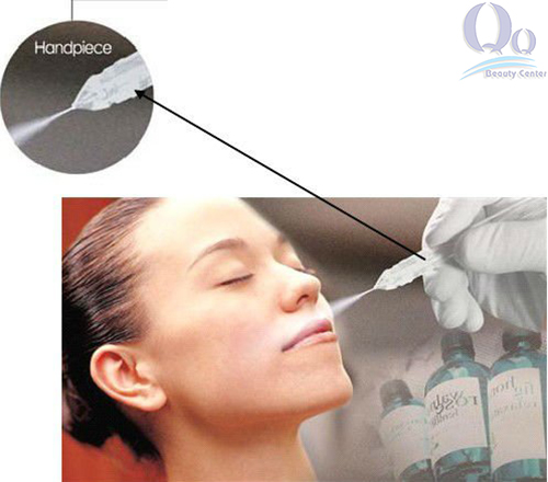 tri mun cam o mui hinh anh 2