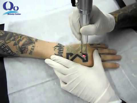 cach xoa xam o canh tay hinh anh 2