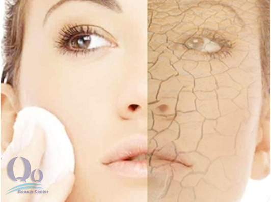 Làm gì khi da mặt bị khô bong tróc